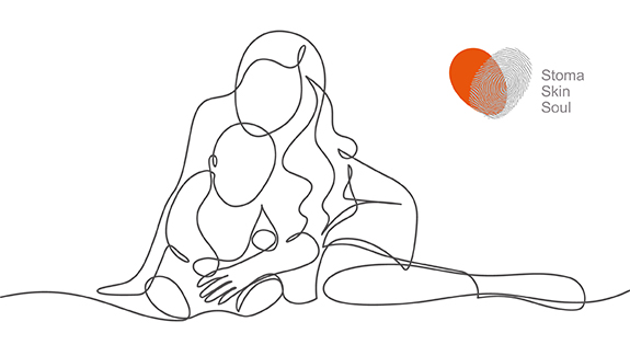 family-enjoying-breakfast-together-on-back-porch-deciding-what-to-eat-after-stoma-surgery